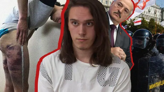 Белорусская милиция, Александр Лукашенко, пострадавший