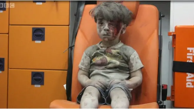 Омран из Алеппо