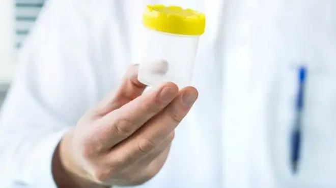 የወንድ የዘር ፍሬ