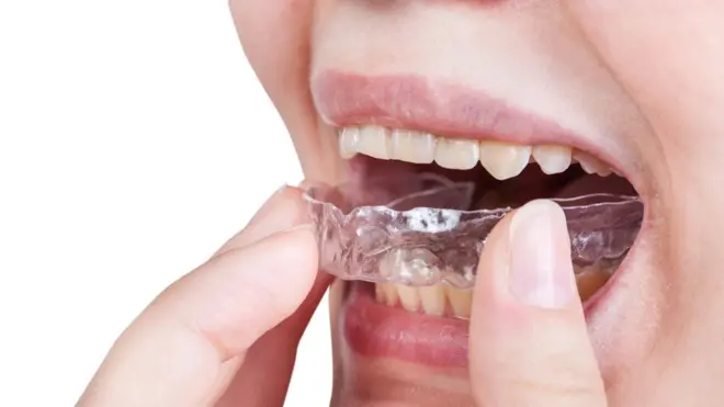 Muchas personas no saben que padecen bruxismo, sobre todo cuando el hábito es nocturno.