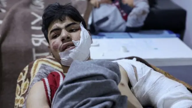 En Turquía se estima que cerca de 5.300 personas resultaron heridas por el terremoto.