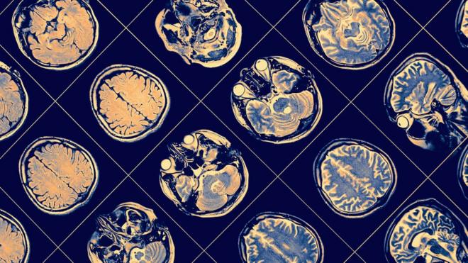 Exameesporte da sorte como jogarimagem cerebral, mostrando cérebro e cabeçaesporte da sorte como jogarvárias posições