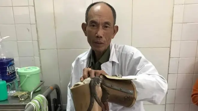 Ông Hoàng Tiến Vin, 62 tuổi là thương binh hạng 2/4.