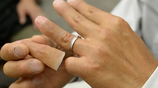 Seorang mantan anggota sindikat kriminal Yakuza memperlihatkan jari kelingkingnya yang dipotong sebagai tanda kesetiaan pada gengnya itu.