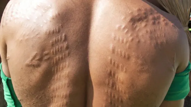 ቆዳው የተበሳ የአካባቢው ተወላጅ