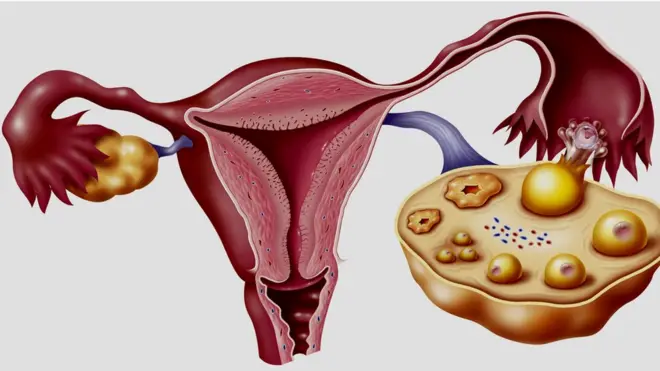Etu nsọ nwaanyị si amalite