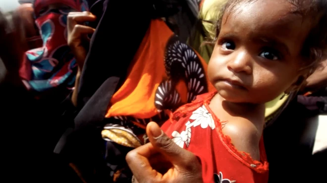 Гуманитарный кризис в Йемене принял масштабы катастрофы