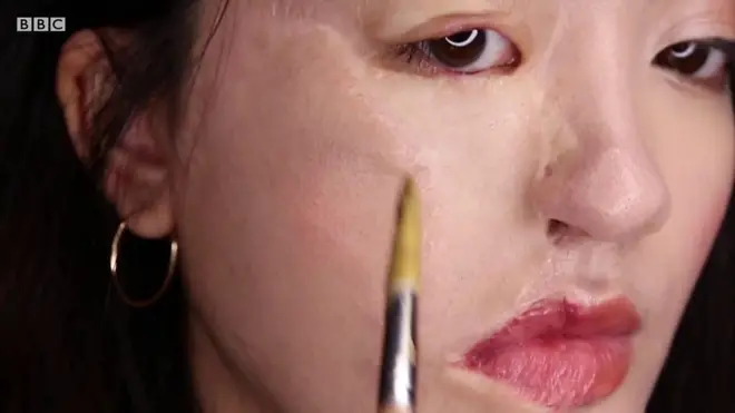 이사벨라는 어린 시절 사고로 얼굴에 상처가 생겼다