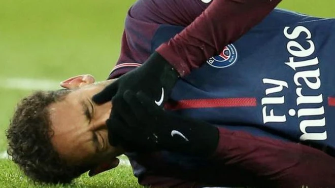 Neymar merụrụ ahụ n'asọmpi PSG na Olympics Marseille gbara n'ụbọchị 25 nke Febụwarị 2018