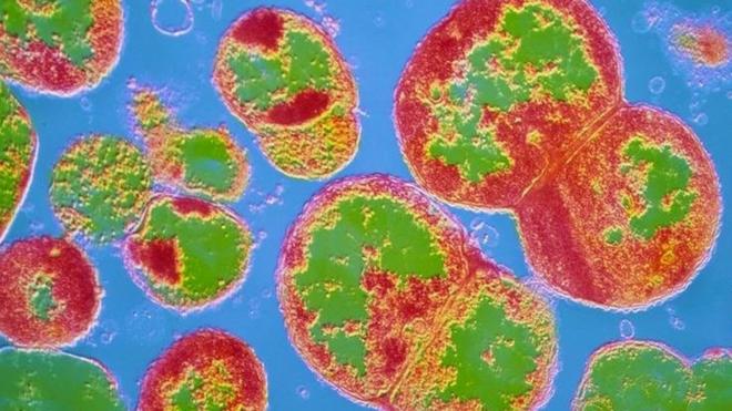 Bactéria da gonorreia