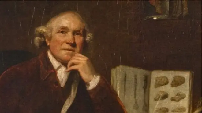 سرجن جان ہنٹر نے سنہ 1786 میں پتھر کی طرح سخت ٹیومر کی تشخیص کی تھی