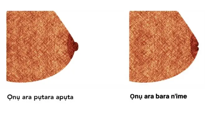 Ọnụ ara