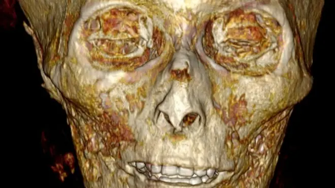 Siitii iskaaniin buqqee mataa Ameenhoteep kaafame