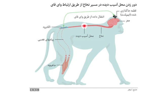 استفاده از دو تراشه ارتباط بین مغز و عصب محرک عضلات پا را مجددا برقرار می‌کند