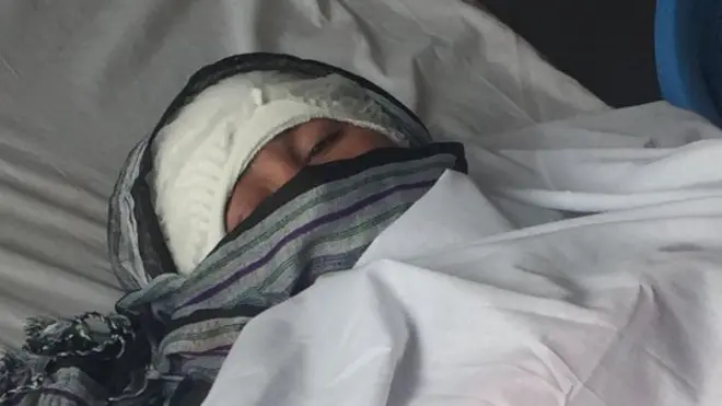 هر دو گوش زرینه بریده شده است