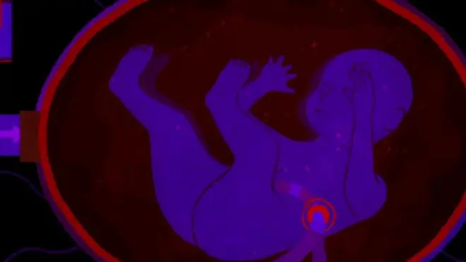 કૃત્રિમ ગર્ભાશય