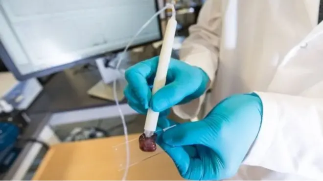 دا قلم د سرطاني عملیاتو په برخه کې لوی پرمختګ بلل کېږي.