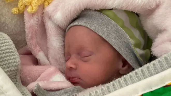 Veronika telah meninggalkan ruang ICU, sementara saudara kembarnya masih membutuhkan lebih banyak perawatan spesialis.