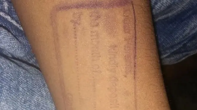 ትምህርት ቤቱ ተማሪው ማስታወሻ ደብተሩን ረስቶ በመምጣቱ በእጁ ላይ ማህተም ለማድረግ መገደዳቸውነ ገልፀዋል።