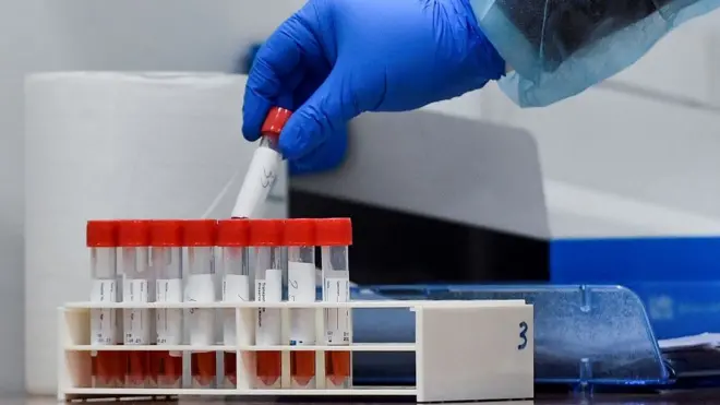 वायरस लैब