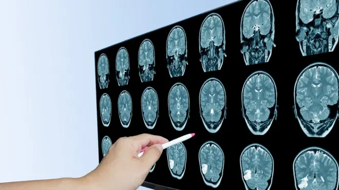 መርመራ ሓንጎል