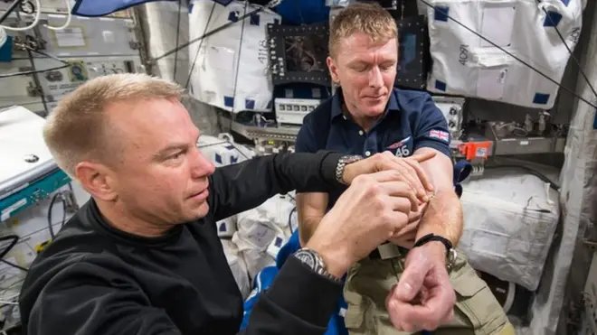 Astronauta britânico Tim Peake tirando amostraesportebet vipsangue para ser estudado; humanos parecem perder glóbulos vermelhos no espaço mais rapidamente do que na Terra, e efeitos são duradouros