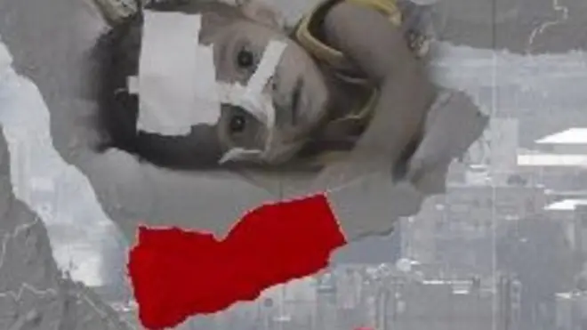 Сім мільйонів дітей Ємену потребують негайної допомоги