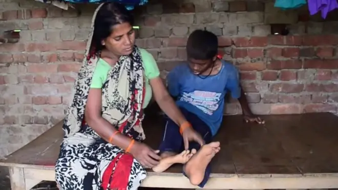 gorakhpur encephalitis