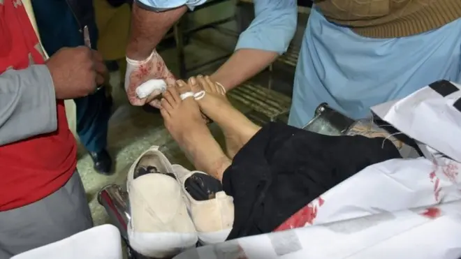 پولیو ورکرز