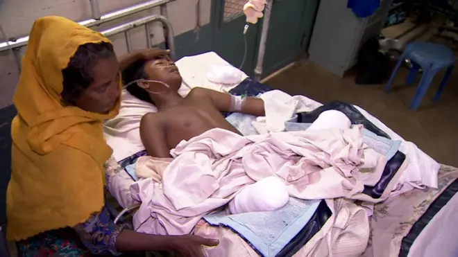 อาซิซู ฮัค วัย 15 ปีได้รับบาดเจ็บสาหัส เสียขาทั้งสองข้าง หลังเหยียบกับระเบิดขณะหลบหนีการปราบปรามเข้าไปในบังกลาเทศ