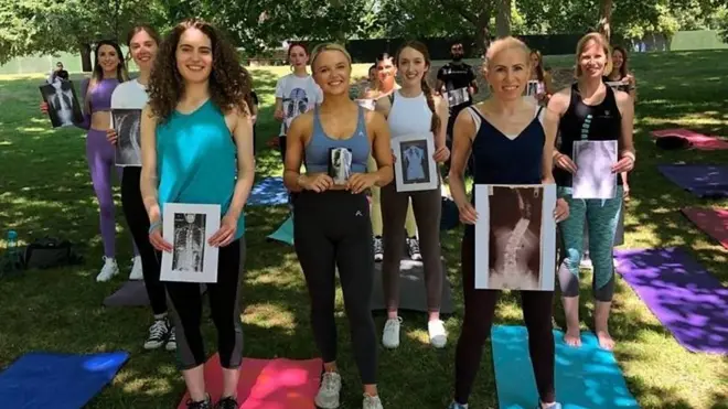 Kako izgleda život sa nevidiljivim invaliditetom