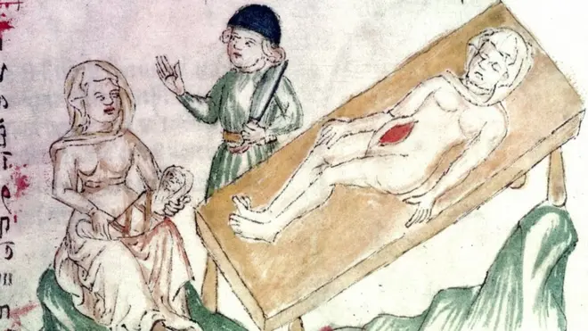 Na era medieval, os médicos já entendiam que o problema afetava tanto mulheres quanto homens