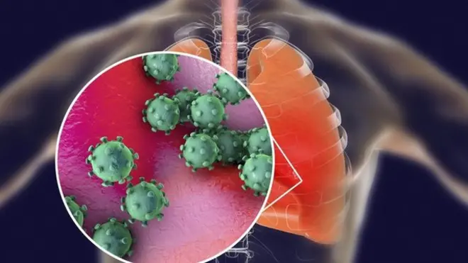 Ўпка ва вирус