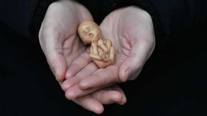 شمالی آئرلینڈ میں اسقاط حمل صرف اس صورت میں کرایا جا سکتا ہے کہ اگر عورت کی زندگی خطرے میں ہو یا پھر اسکی جسمانی یا ذہنی صحت کو مستقل بنیادوں پرخطرہ لاحق ہو