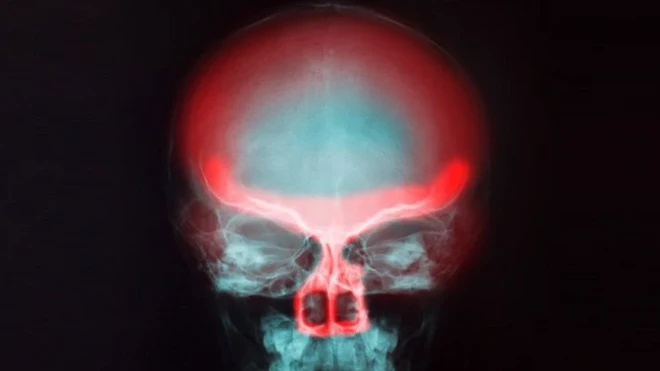 ประสาทรับกลิ่น