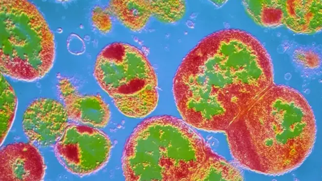 Mikrograf elektron transmisi warna buatan (TEM) Neisseria gonorrhoeae, spesies bakteri penyebab penyakit kelamin gonore.