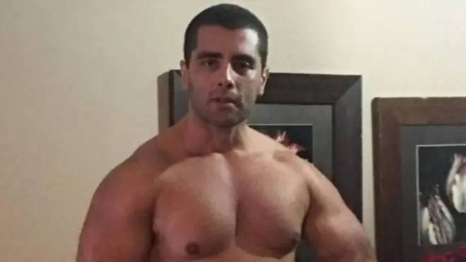 La clientela de Furtado lo seguía en las redes sociales donde publicaba fotos de mujeres tras inyectarles PMMA.