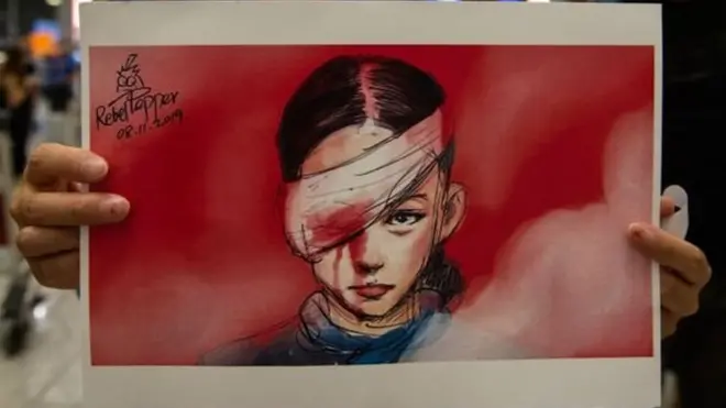 The anonymous woman hit in the eye in Hong Kong has become a symbol of the protests
