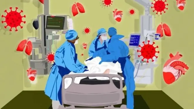gambar ilustrasi perawatan pasien Covid-19.