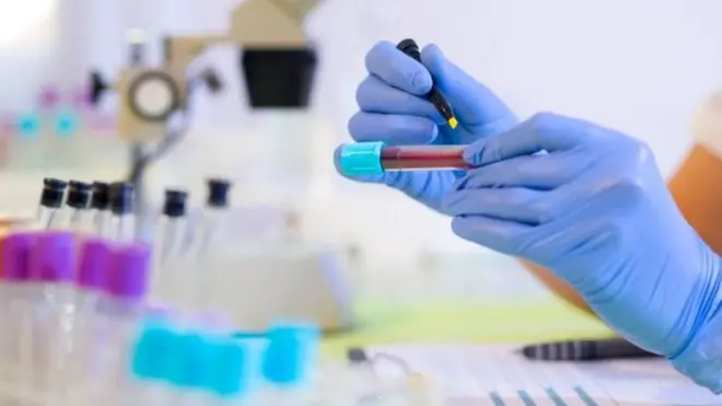 اختبارات الدم