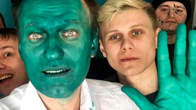Алексей Навальный со сторонниками - после инцидента с зеленкой