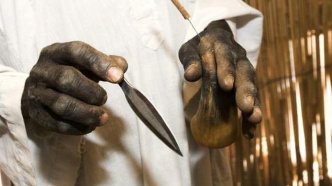 La police de Tanzanie a arrêté 65 sorciers dans le cadre d'une enquête sur des meurtres rituels.