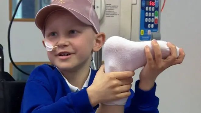 Хирурги повернули ногу девочки пяткой вперед, чтобы прикрепить протез