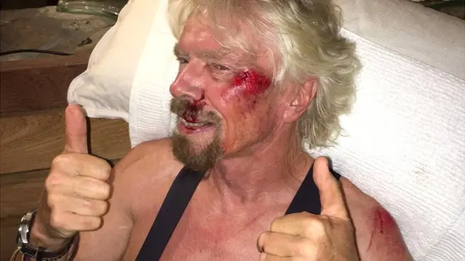 Richard Branson no fue asaltado: sufrió un accidente de bicicleta en agosto de 2016.