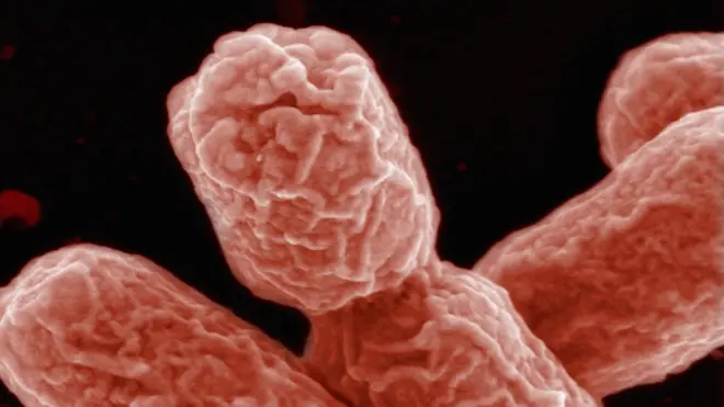 Состав кишечных бактерий, как и ожирение,передается по наследству, отмечают ученые