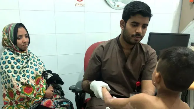 جلنے کے زخم