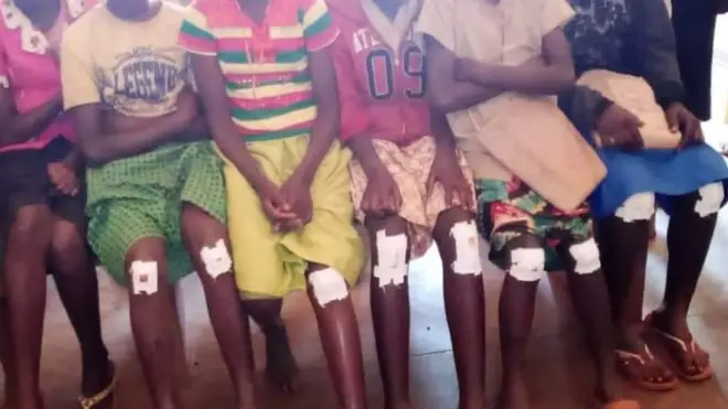 Aba bana bakomerekeye mu gihano bahawe n'umwigisha co kugenda bapfukamye mu mabuye kuko bayobewe umwimenyerezo w'igifaransa