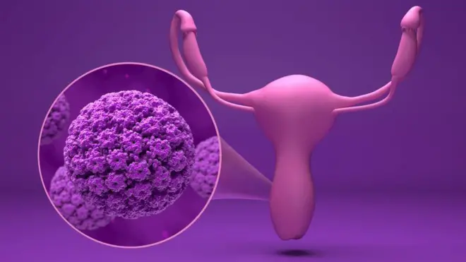 వ్యాక్సీన్, వైద్యం, క్యాన్సర్, మహిళలు