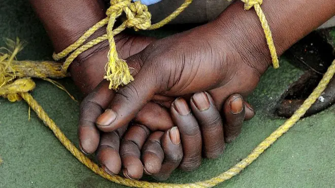 Ọkunrin ti wọn so ọwọ rẹ mọ ẹyin