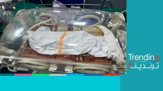 صورة لجثة رضيعة في حاضنة